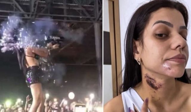 DJ τραυματίστηκε από «όπλο» με κομφετί- Έπαθε εγκαύματα πρώτου βαθμού