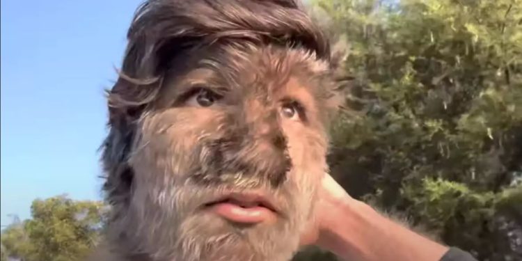 Ο έφηβος από την Ινδία που πάσχει από το σύνδρομο του λυκανθρώπου