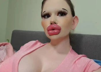 Μοιάζει με «κούκλα Barbie» από 19 ετών και δεν σταματά τις πλαστικές επεμβάσεις – «Πάντα γυρίζουν για να με κοιτάξουν»