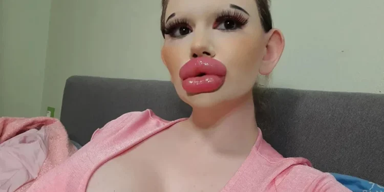 Μοιάζει με «κούκλα Barbie» από 19 ετών και δεν σταματά τις πλαστικές επεμβάσεις – «Πάντα γυρίζουν για να με κοιτάξουν»