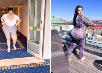 Ξόδεψε 150.000 δολάρια για να… αποκτήσει τα μεγαλύτερα οπίσθια του κόσμου – «Δεν βρίσκω σύντροφο γιατί τρομάζω τους άντρες»