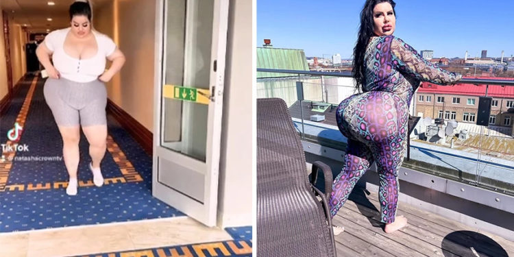 Ξόδεψε 150.000 δολάρια για να… αποκτήσει τα μεγαλύτερα οπίσθια του κόσμου – «Δεν βρίσκω σύντροφο γιατί τρομάζω τους άντρες»