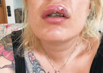 Εικόνα ΣΟΚ – Πλαστικός μετέτρεψε γνωστή αισθητικό σε Gremlin