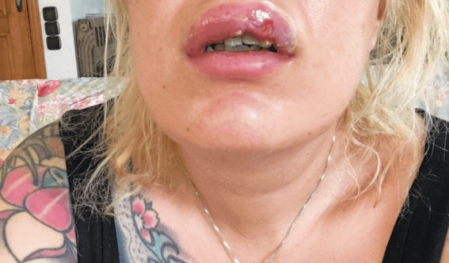 Εικόνα ΣΟΚ – Πλαστικός μετέτρεψε γνωστή αισθητικό σε Gremlin