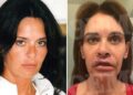 Ελληνίδα συγγραφέας είδε τα χείλη της να «σαπίζουν» μετά από πλαστική επέμβαση(Εικόνες)