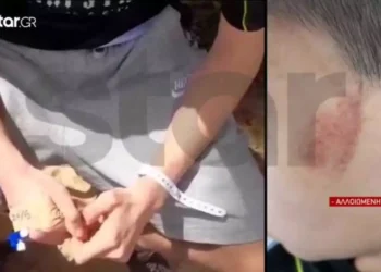 14χρονος θύμα bullying και ξυλοδαρμού από 3 συνομήλικούς του – Νοσηλεύεται στο Παίδων