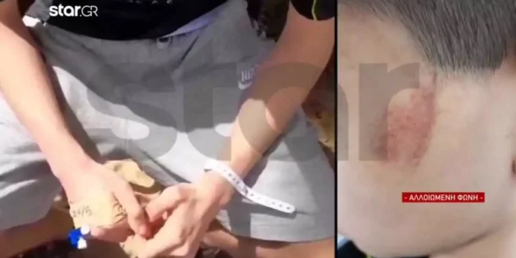14χρονος θύμα bullying και ξυλοδαρμού από 3 συνομήλικούς του – Νοσηλεύεται στο Παίδων