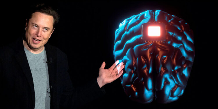 Έλον Μασκ: Η start-up Neuralink του μεγιστάνα θα δοκιμάσει εγκεφαλικά εμφυτεύματα σε ανθρώπους