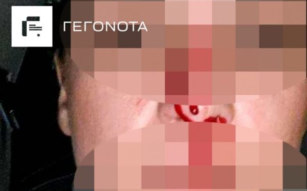 Σάλος στον Βόλο με τον διεθνή αθλητή που επιτέθηκε άγρια στη σύζυγό του – Της έκανε μήνυση αλλά δεν εμφανίστηκε στο δικαστήριο