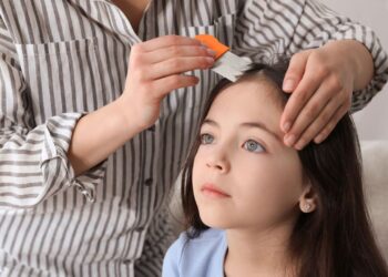 Μητέρα εξομολογείται: “Δεν βγάζω τις ψείρες από τη 7χρονη κόρη μου γιατί είμαι βίγκαν & δε σκοτώνω ζωντανά όντα”