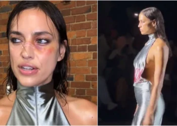 Ιρίνα Σάικ: Με μώλωπες στην Εβδομάδα Μόδας του Λονδίνου – Βίντεο και φωτογραφίες