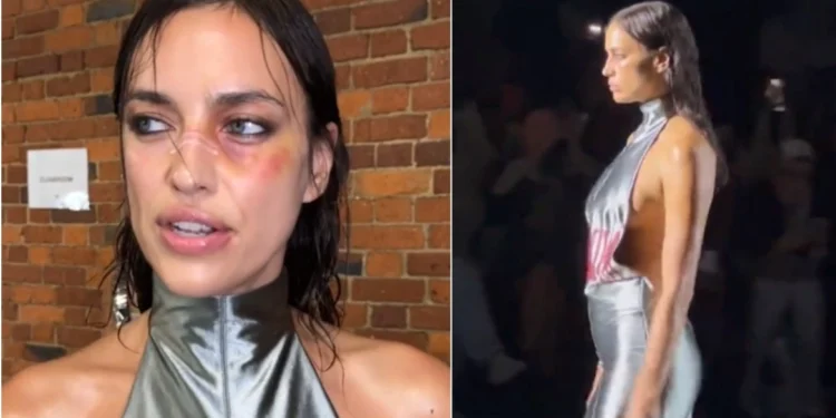 Ιρίνα Σάικ: Με μώλωπες στην Εβδομάδα Μόδας του Λονδίνου – Βίντεο και φωτογραφίες