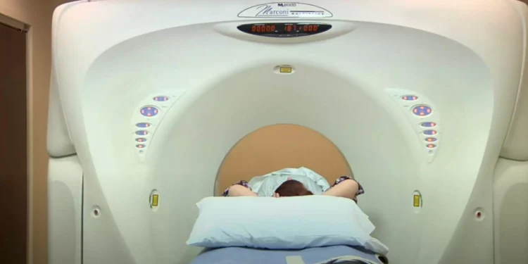 Γυναίκα ζει 80 χρόνια με μια βελόνα καρφωμένη στο εγκέφαλο