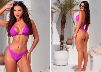 Βραζιλιάνα τηλεπερσόνα πέθανε μετά από λιποαναρρόφηση στο γόνατο