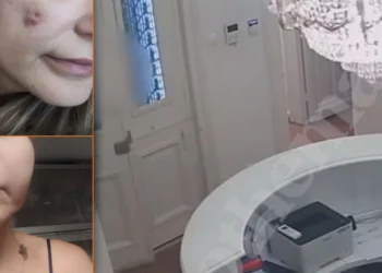 Το ινστιτούτο της απάτης: Τους κατέστρεφαν τα πρόσωπα με «μαϊμού» μπότοξ – Στο φως τρεις νέες δικογραφίες