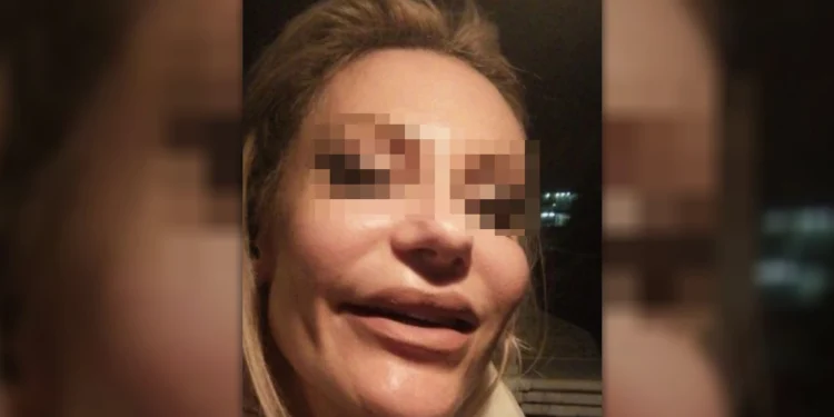 Νέα καταγγελία για το ινστιτούτο της απάτης: «Τα μάγουλά μου πέτρωσαν, είχα αφόρητους πόνους»