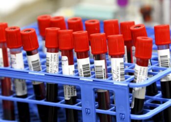 Εξετάσεις από τα δημόσια νοσοκομεία σε ιδιωτικά διαγνωστικά – Τι σχεδιάζει το υπουργείο Υγείας