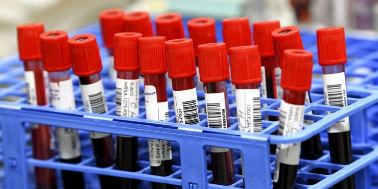 Εξετάσεις από τα δημόσια νοσοκομεία σε ιδιωτικά διαγνωστικά – Τι σχεδιάζει το υπουργείο Υγείας