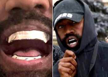Κάνιε Γουέστ: Αφαίρεσε τα δόντια του και έβαλε μασέλα από τιτάνιο αξίας 850.000 δολαρίων