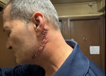 ΗΠΑ: Ουρούσε σε αυτοκίνητο και έκοψε το λαιμό άντρα που του έκανε παρατήρηση