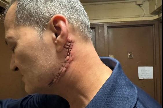 ΗΠΑ: Ουρούσε σε αυτοκίνητο και έκοψε το λαιμό άντρα που του έκανε παρατήρηση