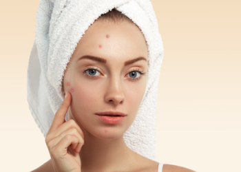 Αυτές είναι μερικές από τις υποσχόμενες θεραπείες για την καταπολέμηση της ακμής