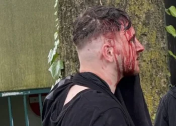 Euro 2024: Άγριο ξύλο μεταξύ Άγγλων και Σέρβων οπαδών – Εμπλοκή και Αλβανών στα επεισόδια  – Βίντεο