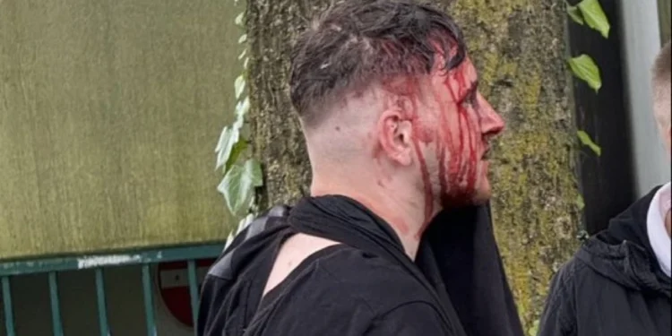 Euro 2024: Άγριο ξύλο μεταξύ Άγγλων και Σέρβων οπαδών – Εμπλοκή και Αλβανών στα επεισόδια – Βίντεο