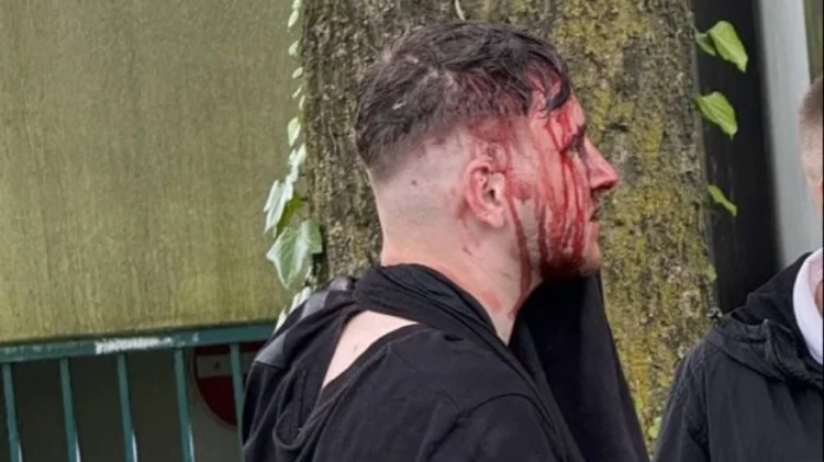 Euro 2024: Άγριο ξύλο μεταξύ Άγγλων και Σέρβων οπαδών – Εμπλοκή και Αλβανών στα επεισόδια  – Βίντεο