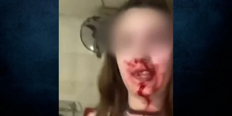 Άμφισσα: Γυναίκα κατήγγειλε με αίματα στο πρόσωπο τον ξυλοδαρμό από τον σύζυγό της