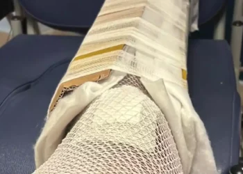 Αδιανόητο περιστατικό σε νοσοκομείο στη Σικελία: Δεν είχαν γύψο και έδεσαν το πόδι 30χρονου μέσα σε χάρτινο κουτί