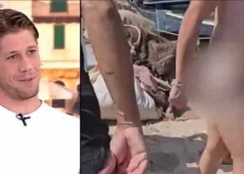 Ο πορνοστάρ που τον δάγκωσε η χελώνα στην Ανάβυσσο έδειξε την πληγή στα οπίσθια: «Μου άφησε σημάδι» (vid)