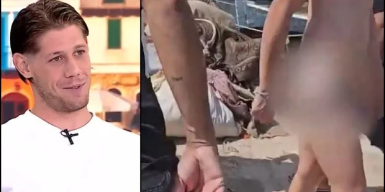 Ο πορνοστάρ που τον δάγκωσε η χελώνα στην Ανάβυσσο έδειξε την πληγή στα οπίσθια: «Μου άφησε σημάδι» (vid)