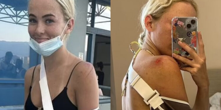 Κέρκυρα: Τρομακτικό τροχαίο με γουρούνα – Βρετανίδα δείχνει τα τραύματά της και η περιγραφή της σοκάρει