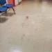 Ρομά διέλυσαν το Κέντρο Υγείας Σπάτων και χτύπησαν γιατρό και έναν φύλακα