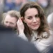 Κέιτ Μίντλετον: Η άγνωστη επέμβαση και η ουλή στο κεφάλι που έκρυβε με τα μαλλιά της