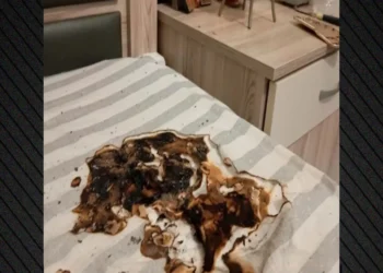 Κινητό τηλέφωνο έσκασε κατά τη διάρκεια της φόρτισης – Πήρε φωτιά το στρώμα, έπαθε έγκαυμα ο ιδιοκτήτης του