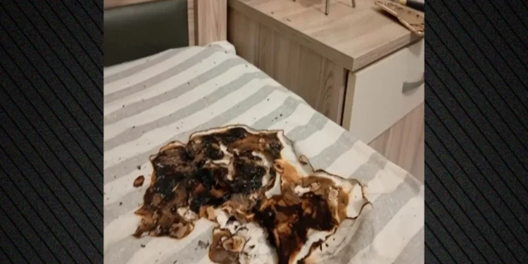 Κινητό τηλέφωνο έσκασε κατά τη διάρκεια της φόρτισης – Πήρε φωτιά το στρώμα, έπαθε έγκαυμα ο ιδιοκτήτης του