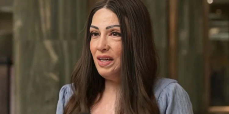 Ιωάννα Παλιοσπύρου: Ακόμα και σήμερα, η γυναίκα που μου έριξε βιτριόλι με κοιτάει στα μάτια με υπεροψία