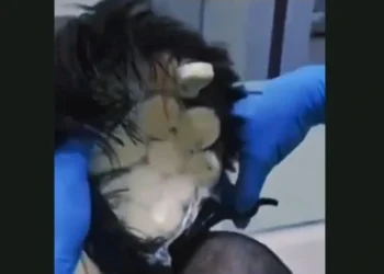 Κολομβία: Έκρυψε κοκαΐνη αξίας €10.000 στην περούκα του για να τη μεταφέρει στην Ολλανδία