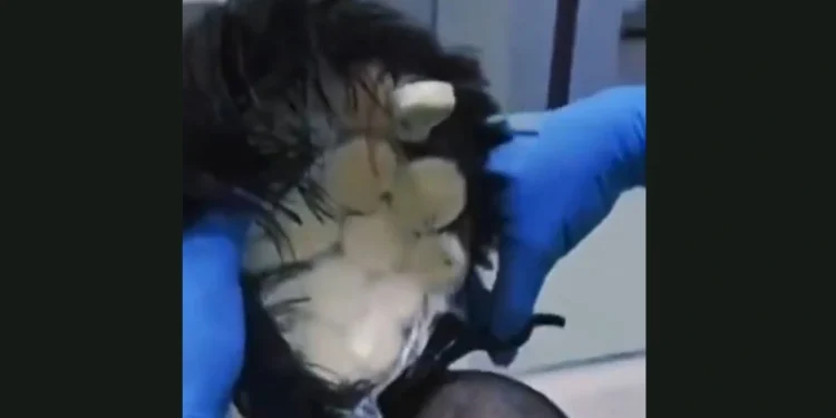 Κολομβία: Έκρυψε κοκαΐνη αξίας €10.000 στην περούκα του για να τη μεταφέρει στην Ολλανδία