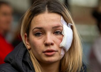 Σκόπια: «Είμαι νεκρός, έχασα το μοναχοπαίδι μου» – Ανατριχιάζουν οι μαρτυρίες από το κλαμπ