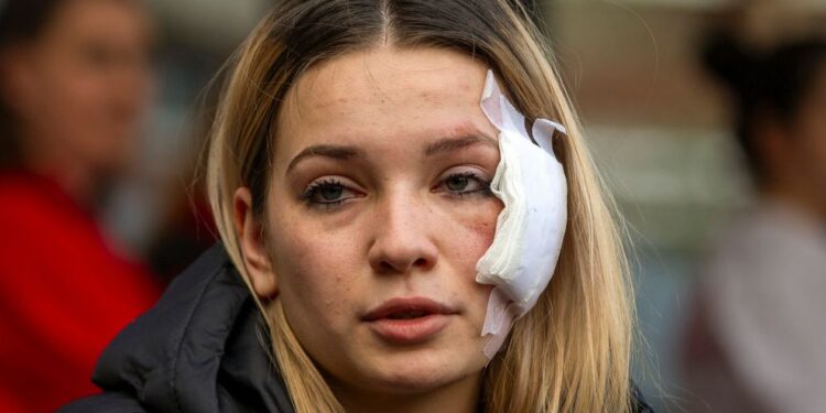 Σκόπια: «Είμαι νεκρός, έχασα το μοναχοπαίδι μου» – Ανατριχιάζουν οι μαρτυρίες από το κλαμπ