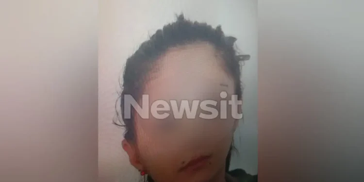 Θεσσαλονίκη: Αυτή είναι η 38χρονη από τη Γεωργία που σκοτώθηκε από την έκρηξη της βόμβας έξω από τράπεζα