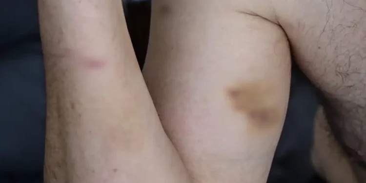 Επιχειρηματίας κατήγγειλε αστυνομικούς για ξυλοδαρμό στη Μύκονο: Τον πέρασαν για τοξικομανή – «Μου χτύπησαν το κεφάλι πάνω στην πόρτα»