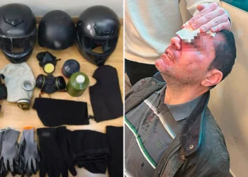 Επίθεση στη Νομική: Στο μικροσκόπιο οι επαφές της 29χρονης γιατρού – Εξετάζουν σύνδεση με τους «ενοικιαστές» των Αμπελοκήπων