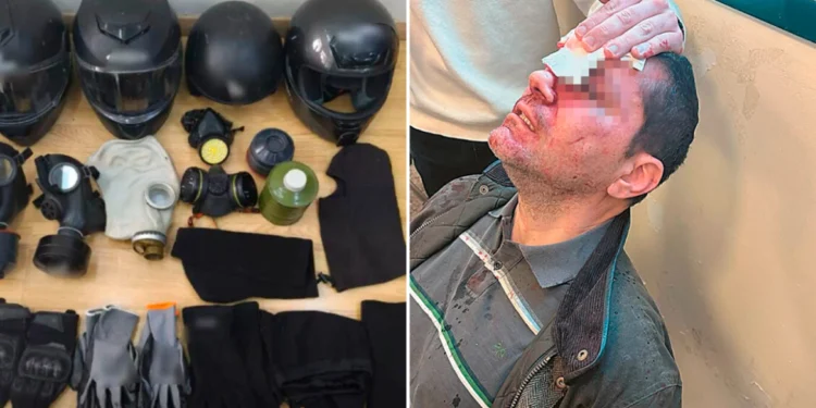 Επίθεση στη Νομική: Στο μικροσκόπιο οι επαφές της 29χρονης γιατρού – Εξετάζουν σύνδεση με τους «ενοικιαστές» των Αμπελοκήπων