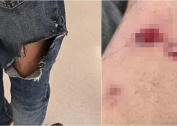 Βουλιαγμένη: Ο σκύλος της οικογένειας Τσιτσιπά επιτέθηκε σε ηλικιωμένο – Είχε δαγκώσει και μαθητή το 2023