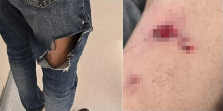 Βουλιαγμένη: Ο σκύλος της οικογένειας Τσιτσιπά επιτέθηκε σε ηλικιωμένο – Είχε δαγκώσει και μαθητή το 2023