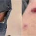 Βουλιαγμένη: Ο σκύλος της οικογένειας Τσιτσιπά επιτέθηκε σε ηλικιωμένο – Είχε δαγκώσει και μαθητή το 2023